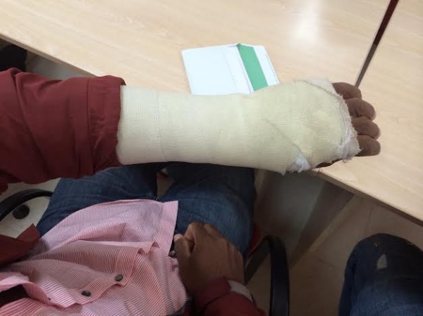 El brazo herido de Doumantaine en la sede de Cruz Roja en Málaga. / S.Rodrigo